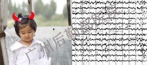 小欢13岁癫痫被治愈